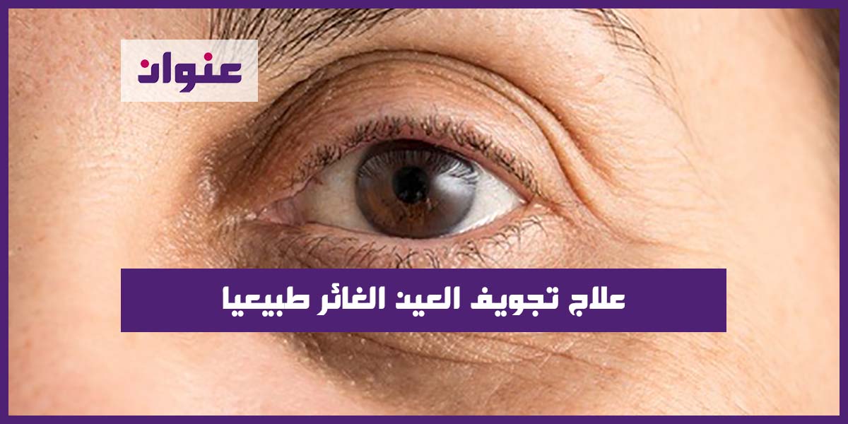 علاج تجويف العين الغائر طبيعيا