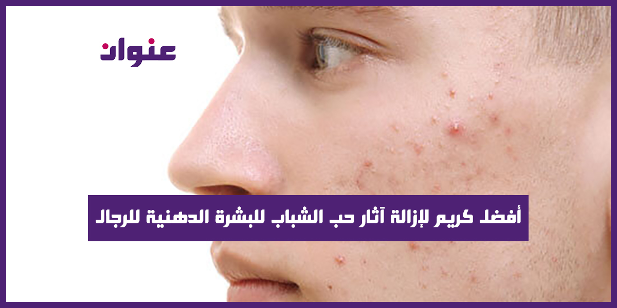 أفضل كريم لإزالة آثار حب الشباب للبشرة الدهنية للرجال