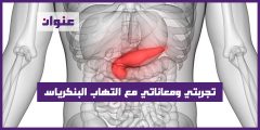 تجربتي ومعاناتي مع التهاب البنكرياس