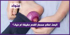 البصل لعلاج مسمار القدم حقيقة ام خيال؟