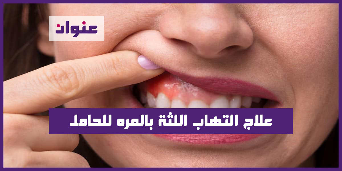 علاج التهاب اللثة بالمره للحامل
