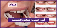 أضرار ابتسامة هوليود المتحركة
