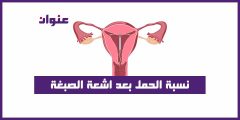 نسبة الحمل بعد اشعة الصبغة