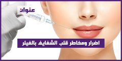 اضرار ومخاطر قلب الشفايف بالفيلر