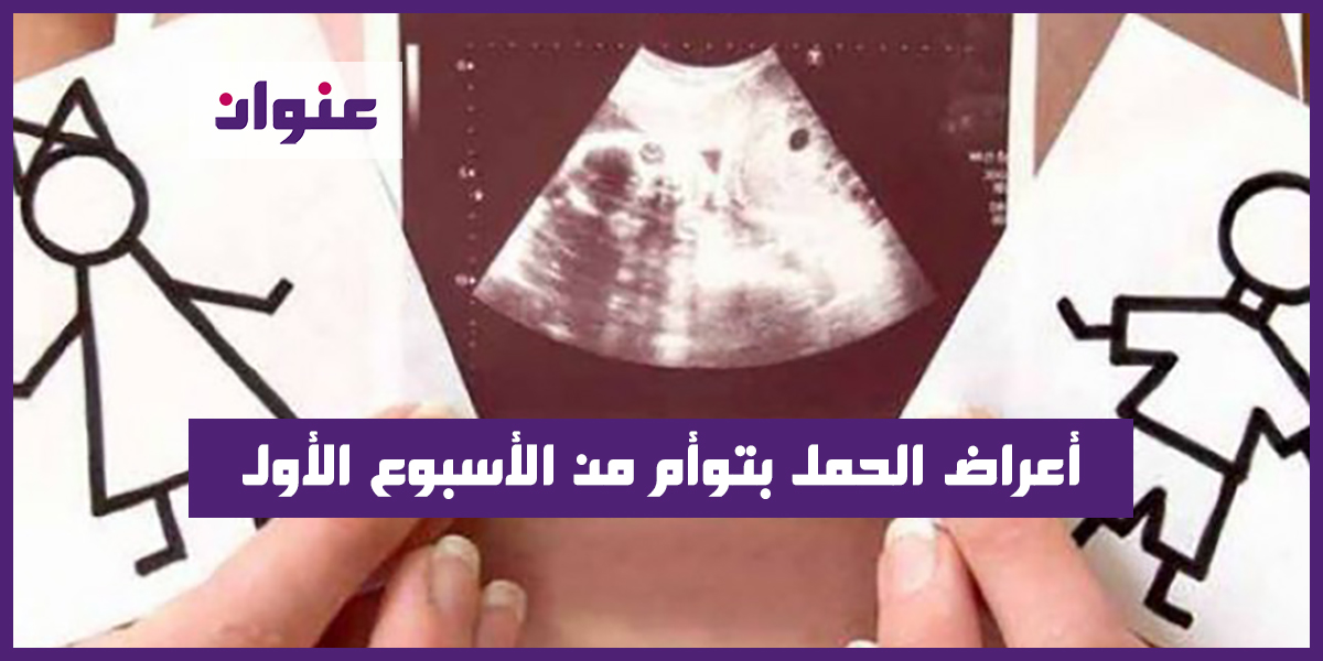 أعراض الحمل بتوأم من الأسبوع الأول