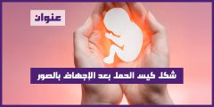 شكل كيس الحمل بعد الإجهاض بالصور