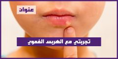 تجربتي مع الهربس الفموي