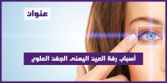 أسباب رفة العين اليمنى الجفن العلوي