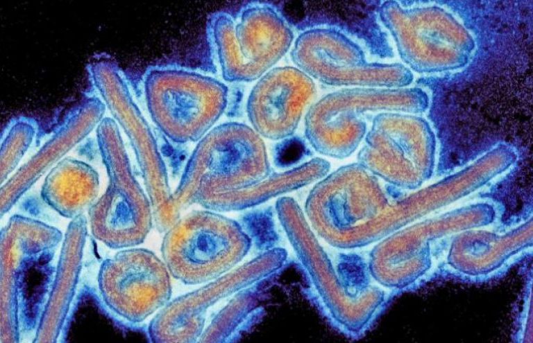 هل وصل فيروس ماربورغ السعودية؟